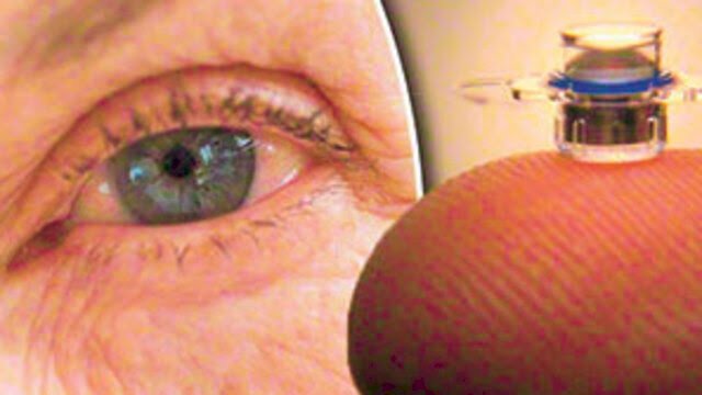 Diyabet tedavisinde göz implantı kullanılabilir açıklaması yapıldı.