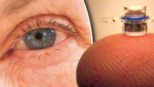 Diyabet tedavisinde göz implantı kullanılabilir açıklaması yapıldı.